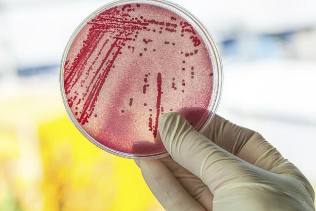 Naučnici pronašli novi antibiotik na krajnje neobičnom mestu
